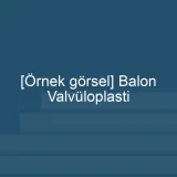 [Örnek içerik] [Örnek görsel] Balon Valvüloplasti görseli.
