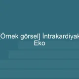 [Örnek içerik] [Örnek görsel] İntrakardiyak Eko görseli.