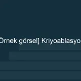 [Örnek içerik] [Örnek görsel] Kriyoablasyon görseli.