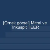 [Örnek içerik] [Örnek görsel] Mitral ve Triküspit TEER görseli.